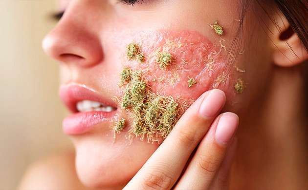 Неролидол: союзник в борьбе за здоровую кожу